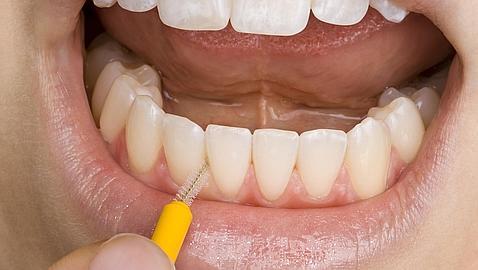 rob dental badalona 1