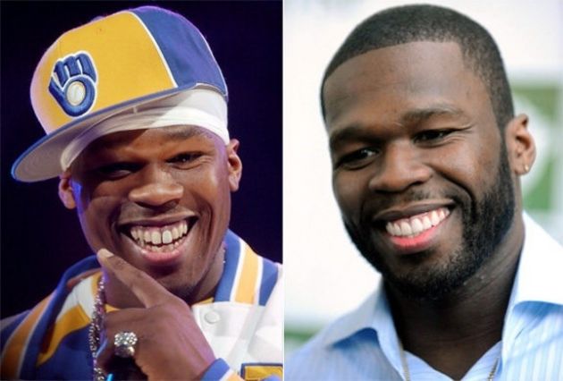 50 CENT implantes denatales