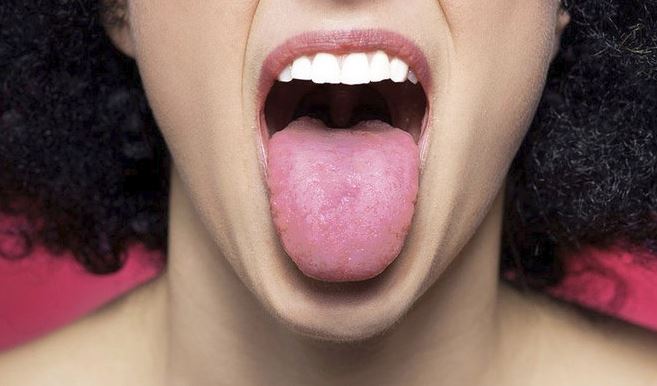 como limpiar la lengua