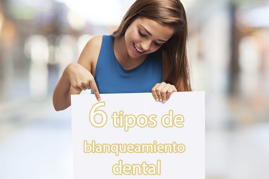 6-tipos-blanqueamiento-dental