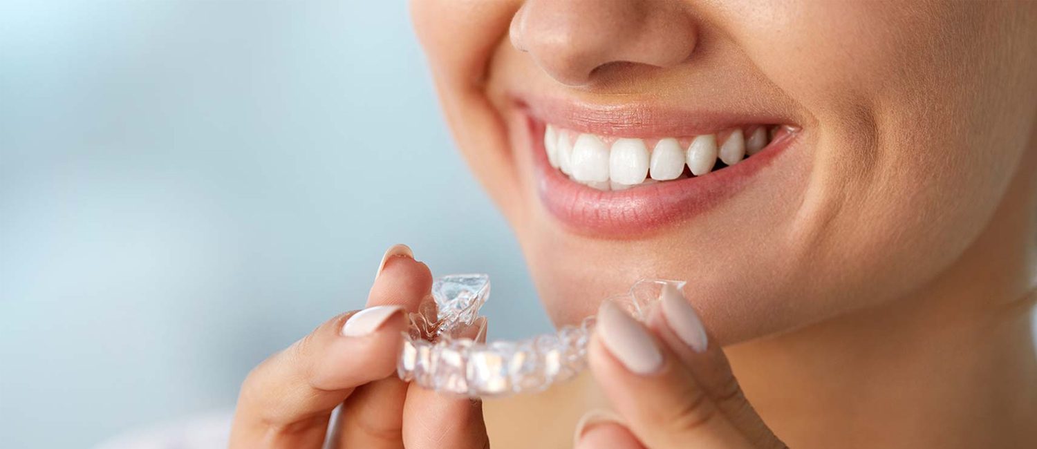 La ortodoncia para una bonita sonrisa