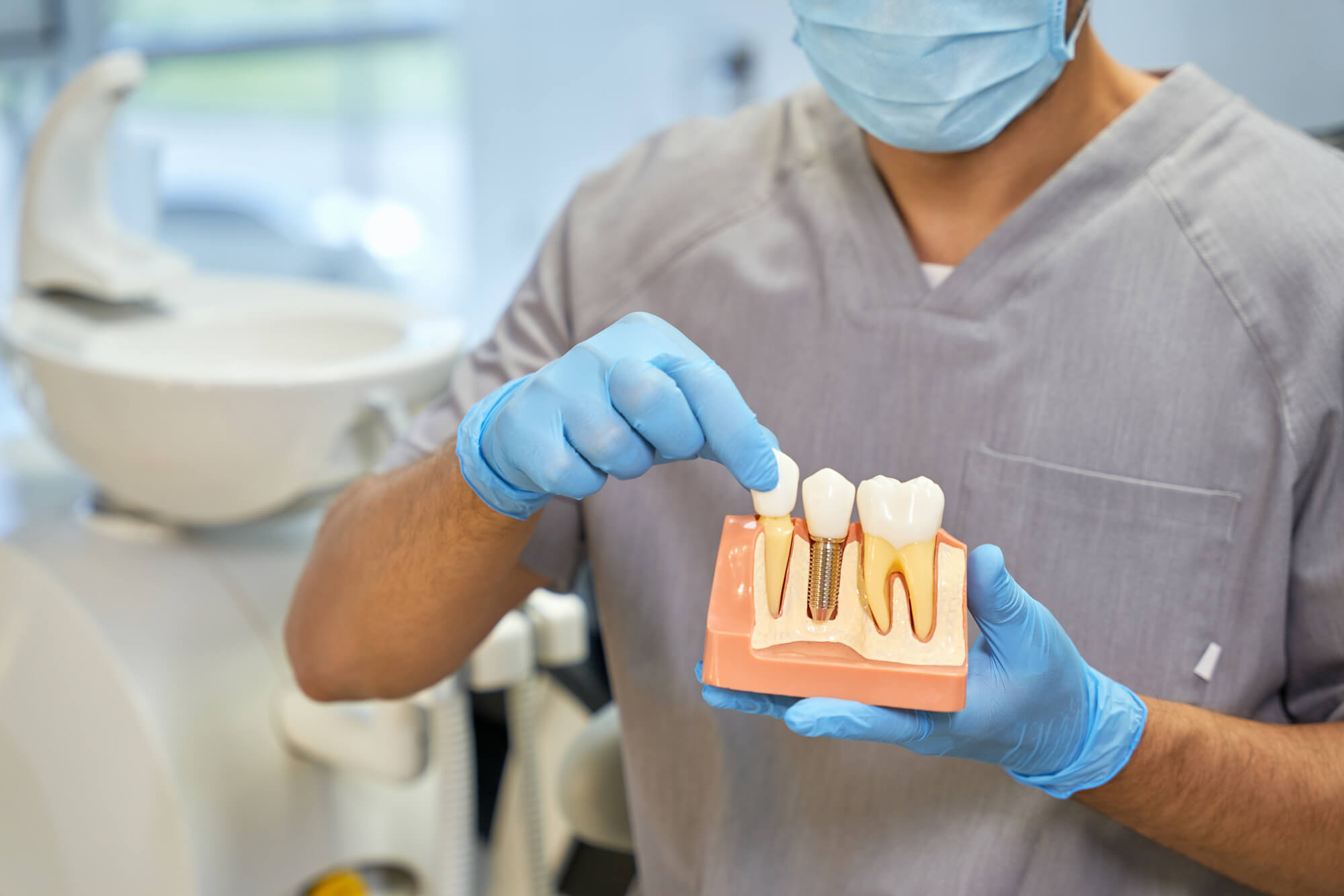 implantes dentales en Badalona