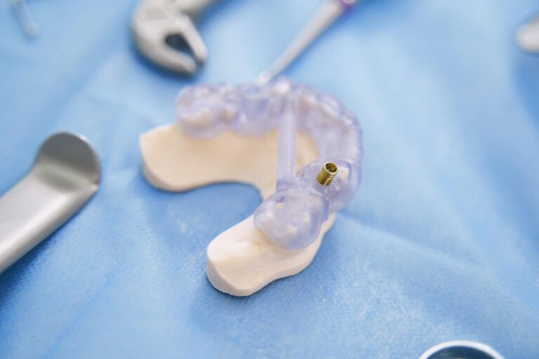 cuidados tras la colocación de un implante dental