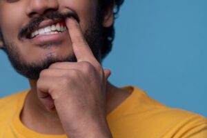 se puede salvar un diente con periodontitis