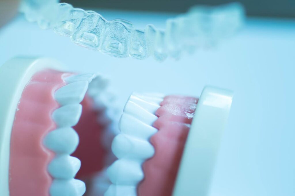 tipos de férulas dentales